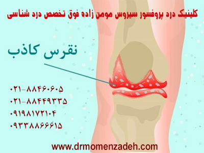 درمان درد نقرس کاذب