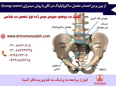 از بین بردن اعصاب مفصل ساکروایلیاک با روش سینرژی (Synergy system)