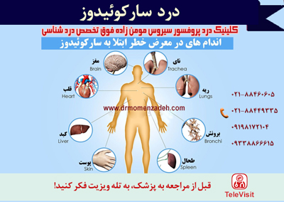 درد سارکوئیدوز