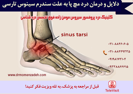 دلایل و درمان درد مچ پا به علت سندرم سینوس تارسی