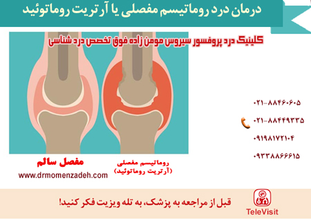 درمان درد روماتیسم مفصلی یا آرتریت روماتوئید