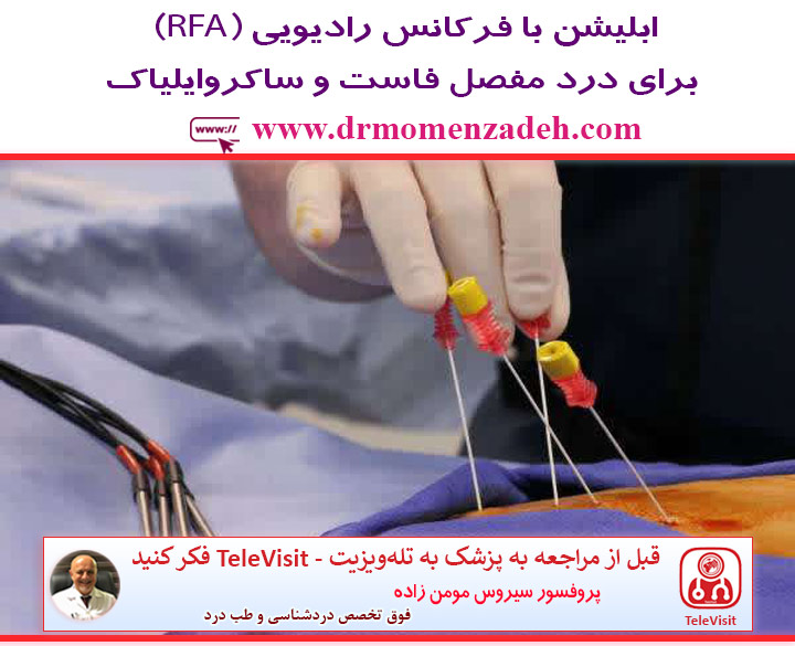 ابلیشن با فرکانس رادیویی (RFA) برای درد مفصل فاست و ساکروایلیاک