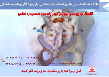 بلاک شبکه عصبی هایپوگاستریک تحتانی برای رهایی از درد لگن و ناحیه تناسلی