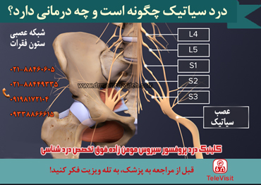 درد سیاتیک چگونه است و چه درمانی دارد