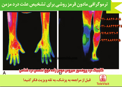ترموگرافی مادون قرمز روشی برای تشخیص علت درد مزمن