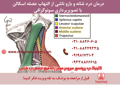 درمان درد شانه و بازو ناشی از التهاب عصله اسکالن با تصویربرداری سونوگرافی