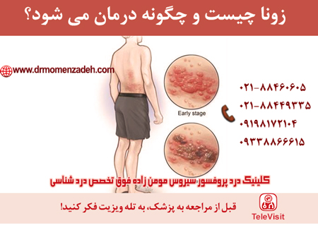 زونا چیست و چگونه درمان می شود؟