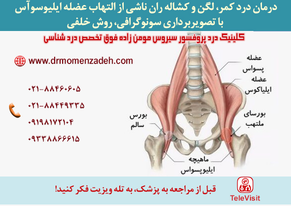 درمان درد کمر، لگن و کشاله ران ناشی از التهاب عضله ایلیوسوآس با تصویربرداری سونوگرافی، روش خلفی