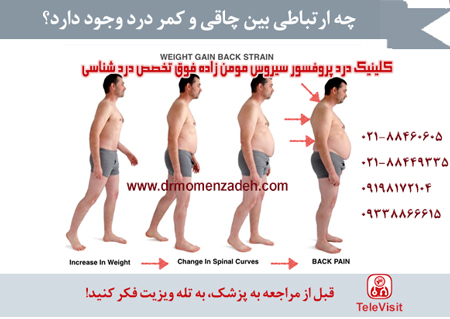 چه ارتباطی بین چاقی و کمر درد وجود دارد؟