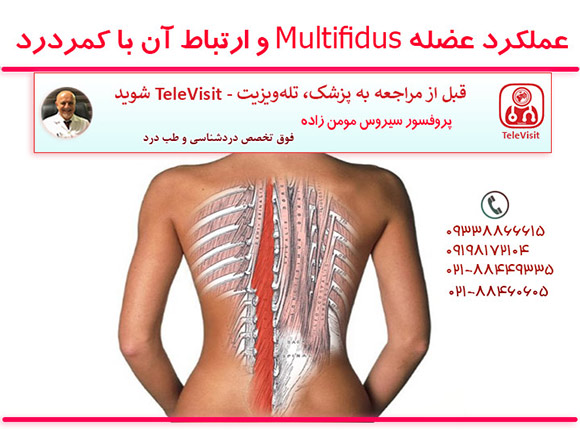 عملکرد عضله Multifidus و ارتباط آن با کمردرد