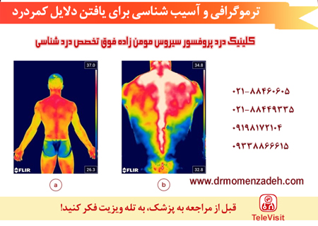 ترموگرافی و آسیب شناسی برای یافتن دلایل کمردرد