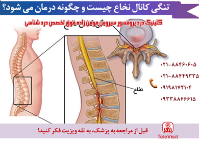 تنگی کانال نخاع چیست و چگونه درمان می شود؟