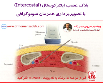 اعصاب اینترکوستال