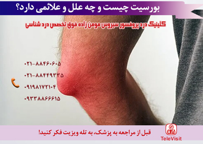 بورسیت چیست و چه علل و علائمی دارد؟