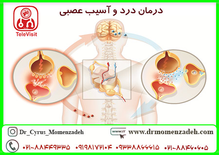 درمان درد و آسیب عصبی