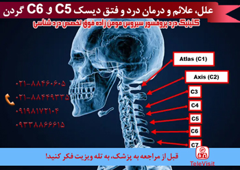 علل، علائم و درمان درد و فتق دیسک c5 و c6 گردن