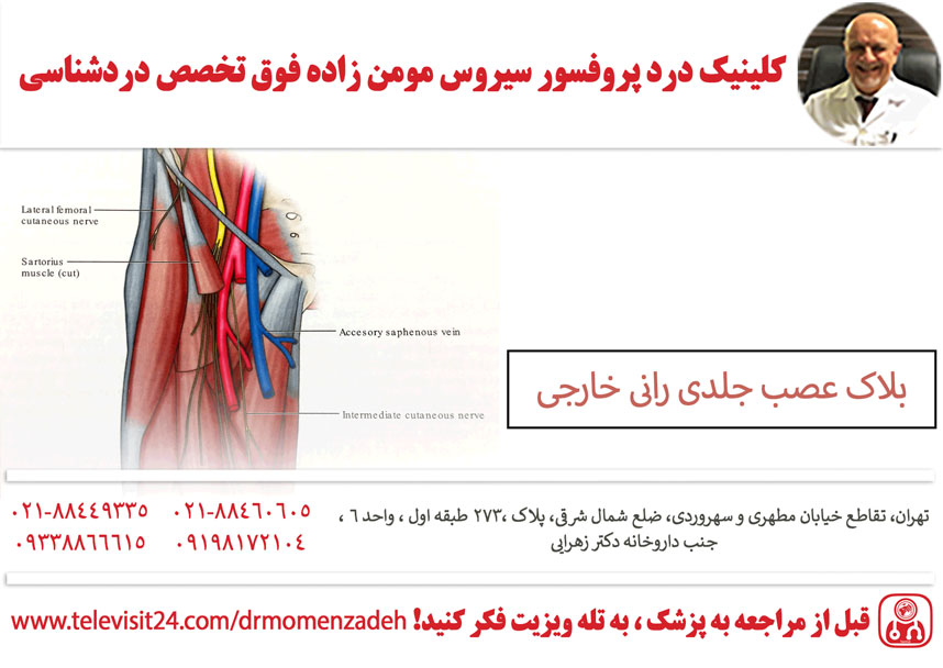 بلاک عصب جلدی رانی خارجی (Lateral femoral cutaneous)