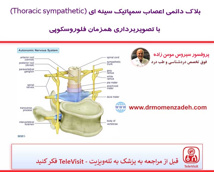 بلاک دائمی اعصاب سمپاتیک 