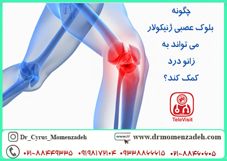 چگونه بلوک عصبی ژنیکولار می تواند به زانو درد کمک کند؟