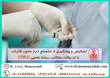 تزریقات منتخب ریشه عصبی (SNRI)