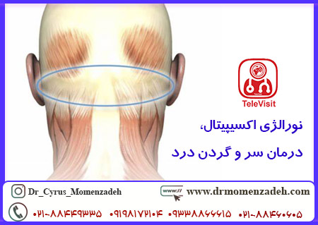 نورالژی اکسیپیتال، درمان سر و گردن درد