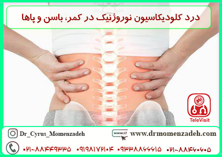 درد کلودیکاسیون نوروژنیک در کمر، باسن و پاها