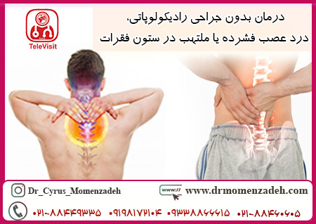 رادیکولوپاتی یک درد عصب فشرده یا ملتهب در ستون فقرات