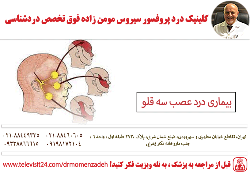 بیماری درد عصب سه قلو