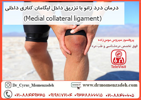 درمان درد زانو با تزریق داخل لیگامان کناری داخلی (Medial collateral ligament)