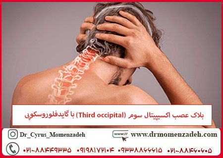 بلاک عصب اکسیپیتال سوم (Third occipital) با گایدفلوروسکوپی