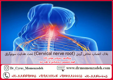 بلاک اعصاب نخاعی گردنی (Cervical nerve root) تحت هدایت سونوگرافی