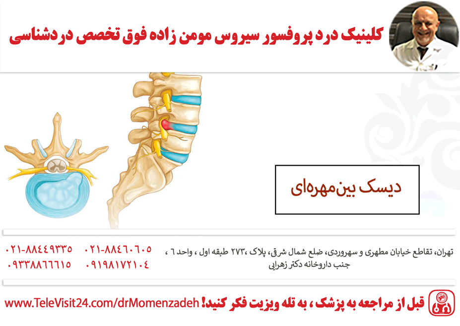 دیسک بین‌مهره‌ای