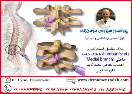 بلاک مفاصل فست کمری (Lumbar facet) با بلاک شاخه داخلی (Medial branch) اعصاب نخاعی تحت گاید فلوروسکوپ