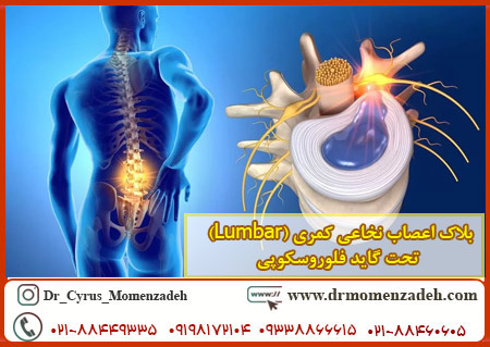 بلاک اعصاب نخاعی کمری (Lumbar) تحت گاید فلوروسکوپی