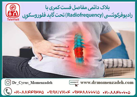 بلاک دائمی مفاصل فست کمری با رادیوفرکوئنسی (Radiofrequency) تحت گاید فلوروسکوپی