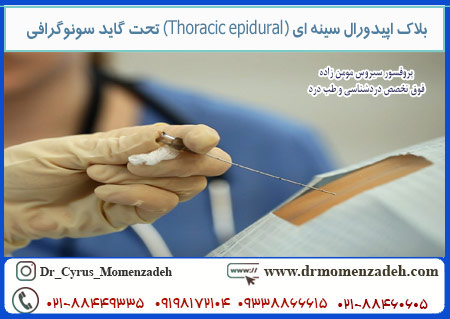 بلاک اپیدورال سینه ای (Thoracic epidural) تحت گاید سونوگرافی