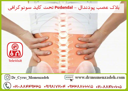 بلاک عصب پودندال - Pudendal تحت گاید سونوگرافی