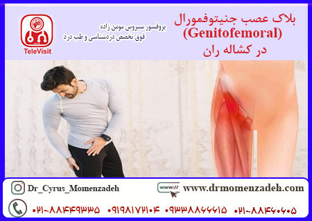 بلاک عصب جنیتوفمورال (Genitofemoral) در کشاله ران