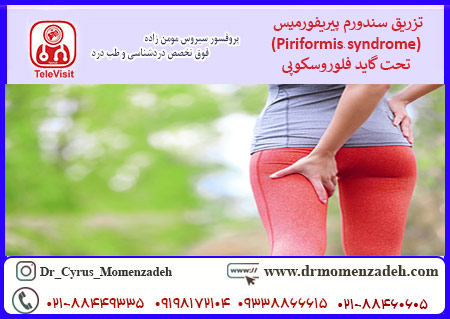 تزریق سندروم پیریفورمیس - Piriformis syndrome تحت گاید فلوروسکوپی