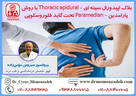 بلاک اپیدورال سینه ای - Thoracic epidural با روش پارامدین - Paramedian تحت گاید فلوروسکوپی