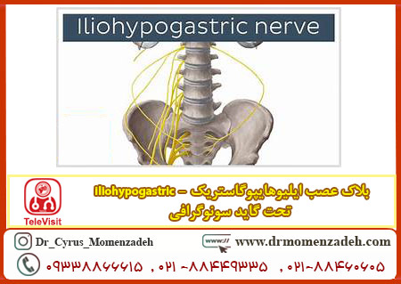 بلاک عصب ایلیوهایپوگاستریک - iliohypogastric تحت گاید سونوگرافی