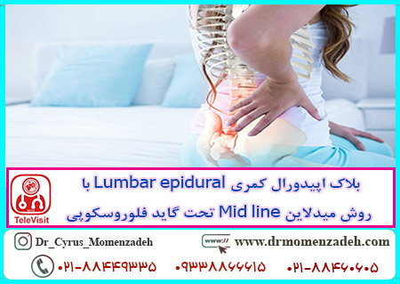 بلاک اپیدورال کمری Lumbar epidural با روش میدلاین Mid line تحت گاید فلوروسکوپی