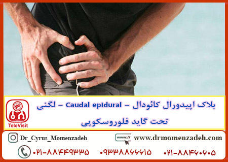 بلاک اپیدورال کائودال - Caudal epidural - لگنی تحت گاید فلوروسکوپی