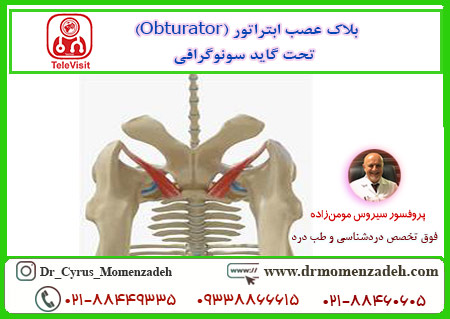 بلاک عصب ابتراتور (Obturator) تحت گاید سونوگرافی