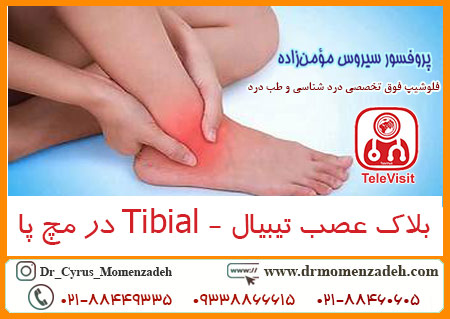 بلاک عصب تیبیال - Tibial در مچ پا