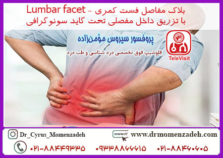 بلاک مفاصل فست کمری - Lumbar facet با تزریق داخل مفصلی تحت گاید سونوگرافی