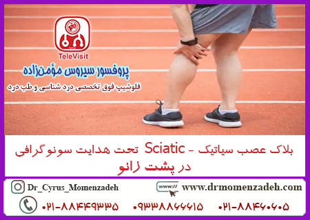 بلاک عصب سیاتیک - Sciatic  تحت هدایت سونوگرافی در پشت زانو