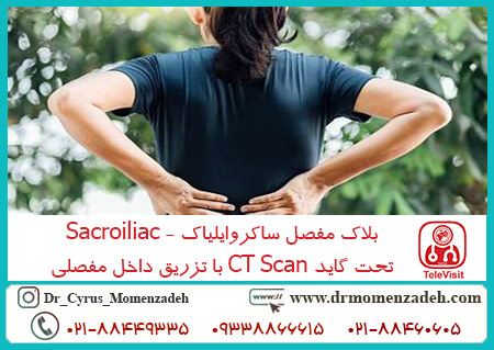 بلاک مفصل ساکروایلیاک - Sacroiliac تحت گاید CT Scan با تزریق داخل مفصلی