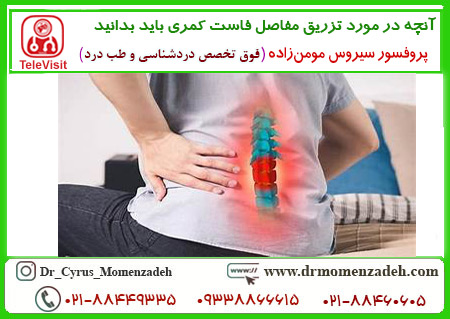 آنچه در مورد تزریق مفاصل فاست کمری باید بدانید