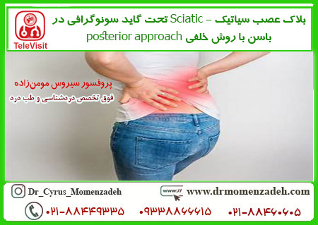 بلاک عصب سیاتیک - Sciatic تحت گاید سونوگرافی در باسن با روش خلفی posterior approach